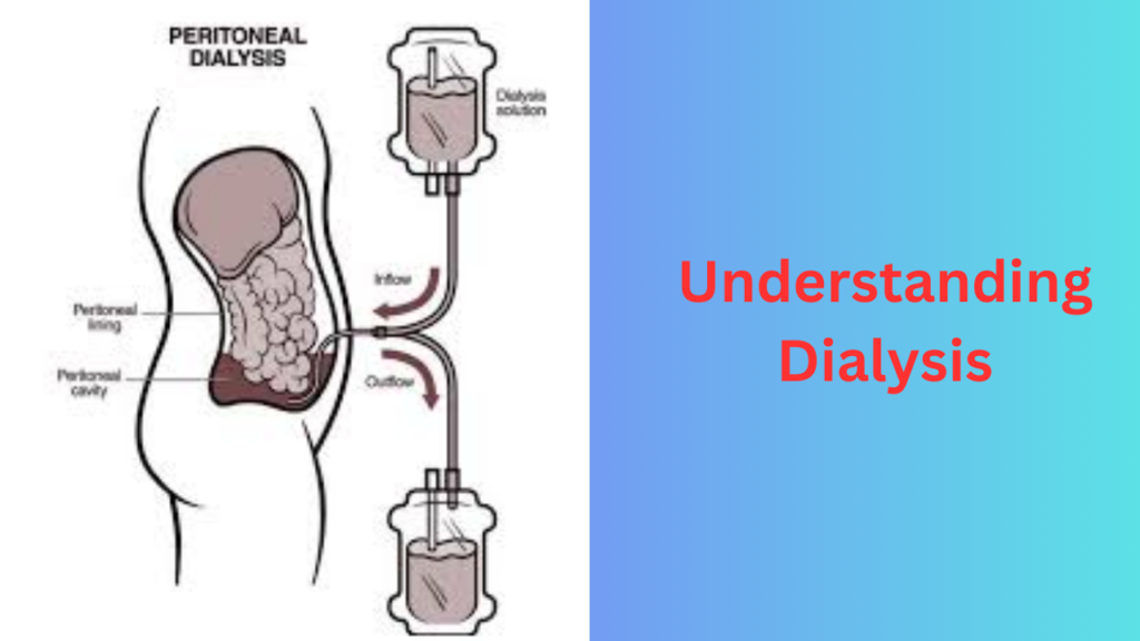 Understanding Dialysis