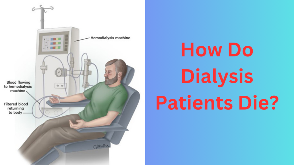 How Do Dialysis Patients Die?